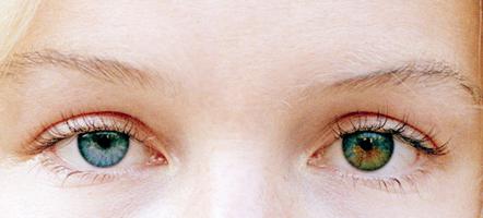 Cilvēka dažādas acis - ko tas nozīmē?